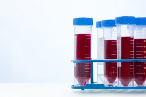 Blood Testing Samples in Laboratory. Covid-19 Blood Test Concept