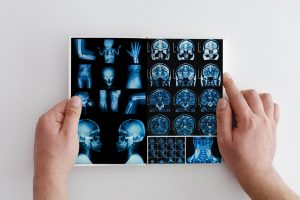 Hands hold MRI scan of head, neck and brain of patient, holding in hands.